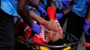 Pemain Bayern Munich, Jamal Musiala Alami Cedera Serius Patah Pergelangan Kaki